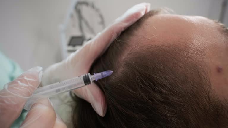 La greffe de cheveux est une solution prisée pour pallier la perte capillaire. Parmi les méthodes disponibles, la technique FUT