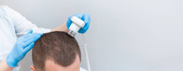 Beaucoup de patients redoutent la douleur après une GREFFE DE CHEVEUX. En effet, la crainte de souffrir freine parfois leur décision.