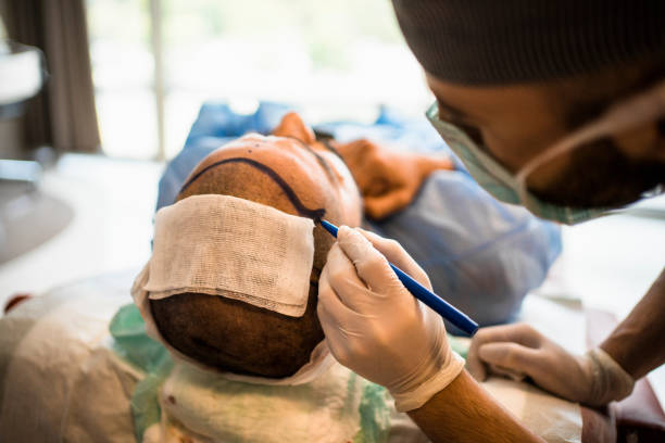 Les témoignages vidéo apportent une preuve concrète de la greffe FUE. En effet, les patients parlent avec sincérité.